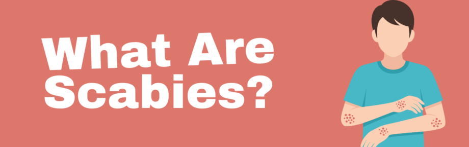 What Are Scabies?